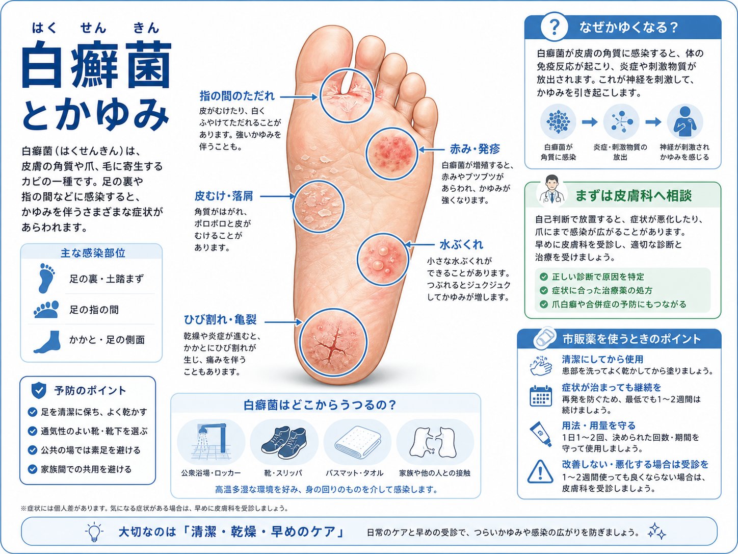 白癬菌 かゆみ を伴う代表的な症状