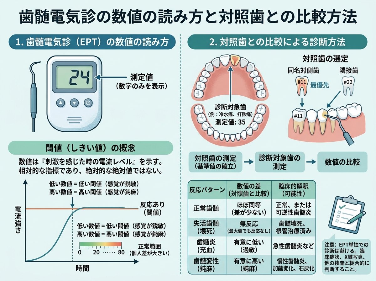 歯髄電気診の数値の読み方と対照歯との比較方法