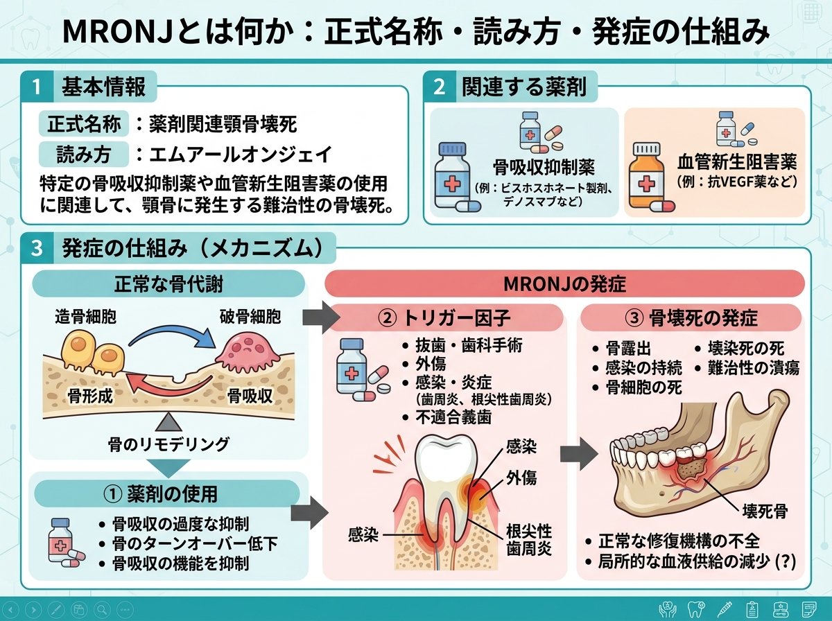 mronjとは何か：正式名称・読み方・発症の仕組み