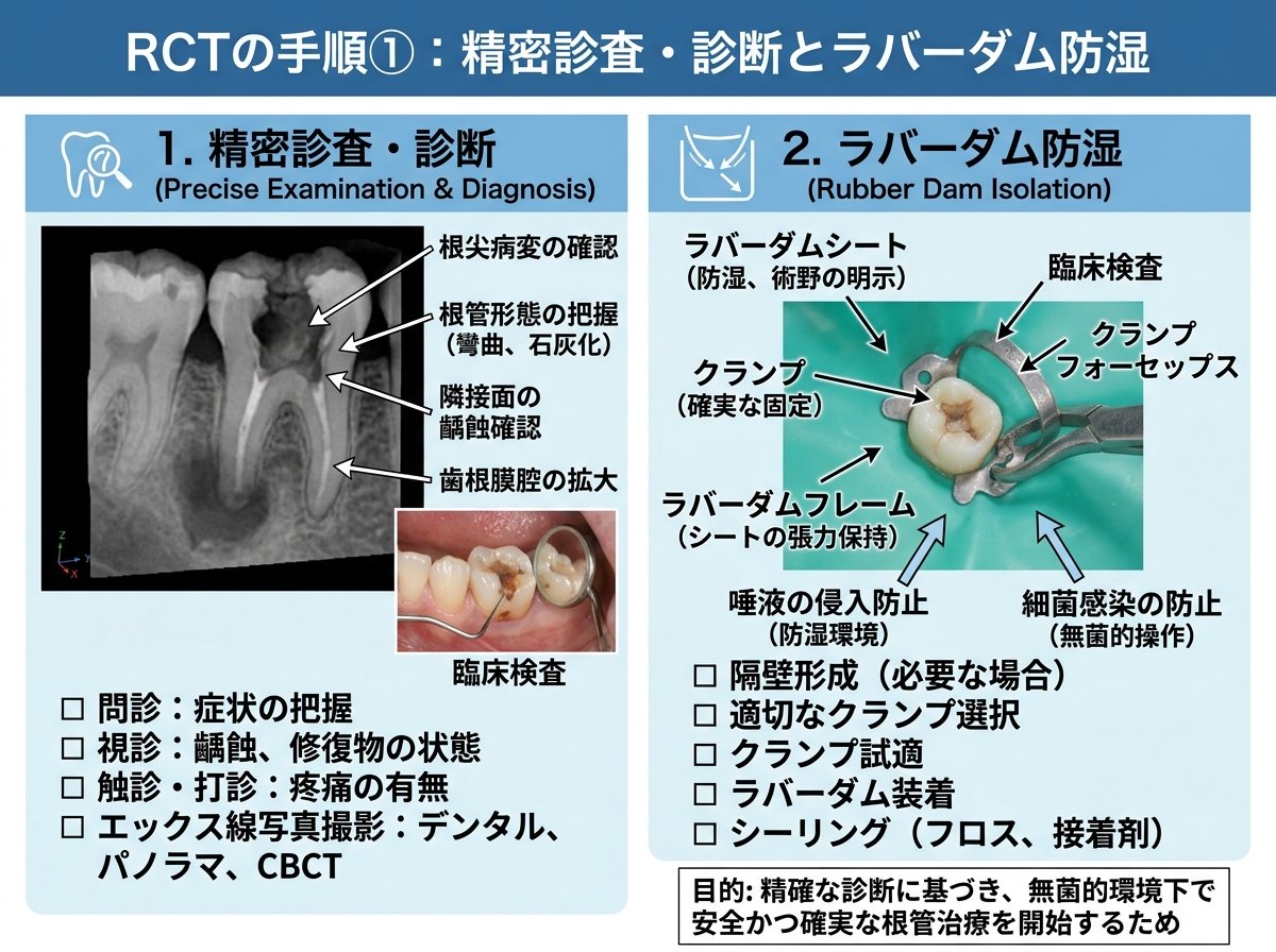 rct歯科の手順①：精密診査・診断とラバーダム防湿